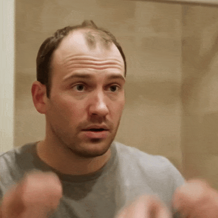 Hombre revisando la caída de su cabello